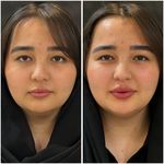 مجموعه لیزر و زیبایی کارنا(شاتی نداریم)