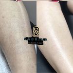 مطب لیزر و پوست و مو سابرینا شعبه نارمک