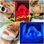 پاکسازی پوست آزیتا