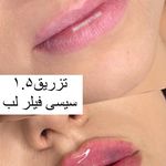 کلینیک لیزر و زیبایی مهسان