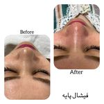 خدمات فیشال بهاره رنجبر