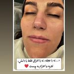 فیشیال و پاکسازی پوست ورسا