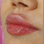 مرکز لیزر و کلینیک زیبایی زرین