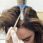 خدمات فیشال و اسکالپ سر آزی