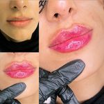 مطب زیبایی دکتر مهسا کاوئی