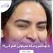 مرکز لیزر و کلینیک زیبایی الیسو