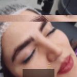 فیشال و پاکسازی پوست مژگان صالحی