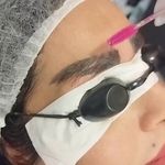 فیشال و پاکسازی پوست مژگان صالحی