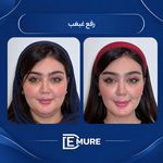 مرکز تخصصی لاغری دمور