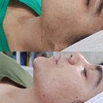 آموزش و خدمات پوست و فیشال رویا باقریان