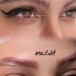 سالن زیبایی و مرکز تخصصی میکرو سما ستوده