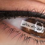 میکروبلدینگ ومیکروپیگمنتیشن حسینی