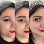 مرکز تخصصی فیبرز ابر‌و حمیده رحیمی