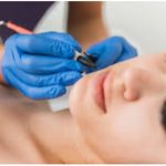 لیزر و لاغری موضعی نگار