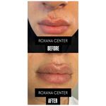 کلینیک پوست مو و زیبایی رکسانا