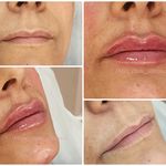 کلینیک زیبایی و لیزر مایا (دکتر وحیدی)