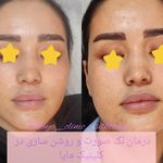 کلینیک زیبایی و لیزر مایا (دکتر وحیدی)