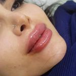 ستيلا  با دكتر مريم هاشمي زنان و زايمان