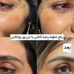 مرکز لیزر وکلینیک زیبایی پایون(بانوان)