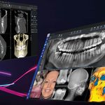 رادیولوژی دهان؛ فک و صورت دکتر حسینی زارچ