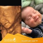 سووگرافی نیلو دکتر فاطمه مهتاب قربانی