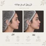 مرکز لیزر ،پوست و زیبایی کندی بیوتی