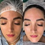 پاکسازی پوست و فیشال تخصصی فریال