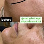 پاکسازی پوست و فیشال تخصصی فریال