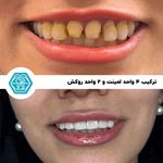 کلینیک دندانپزشکی دیجیتال نگین شیراز