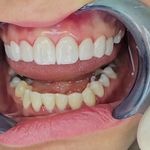 دندانپزشکی دکتر مرتضی شعله سعدی