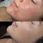 پاکسازی پوست و مو مهسام