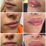 کلینیک لیزر و زیبایی دنیز