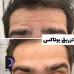 کلینیک زیبایی پوست و مو و لیزر پامچال