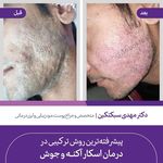 دکتر مهدی سبکتکین