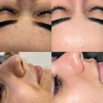 خدمات تخصصی پاکسازی پوست ساجده عنایتی