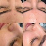 خدمات تخصصی پاکسازی پوست ساجده عنایتی