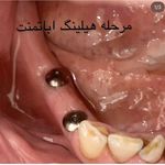 دندانپزشکی دکتر مهدی نعمت الهی