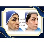 کلینیک پوست مو زیبایی هلیا