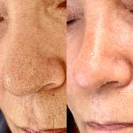 خدمات تخصصی فیشال و پاکسازی پوست صبا