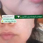 خدمات فیشیال و پاکسازی پوست