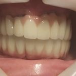 مطب ایمپلنت دکتر نیما شفیعی