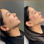 کلینیک پوست و زیبایی ژیلاوَش