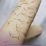 کلینیک لیزر و زیبایی مهسان