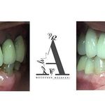 مرکز دندانپزشکی، دندانسازی مظفری