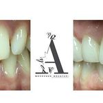 مرکز دندانپزشکی، دندانسازی مظفری