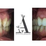 مرکز دندانپزشکی، دندانسازی مظفری