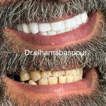 دندانپزشکی و زیبایی دکتر الهام عباسپور