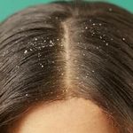 کلینیک تخصصی پوست و مو زیباآفرین