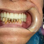مطب ایمپلنت دکتر نیما شفیعی
