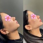 کلینیک زیبایی و لاغری الا بیوتی سنتر